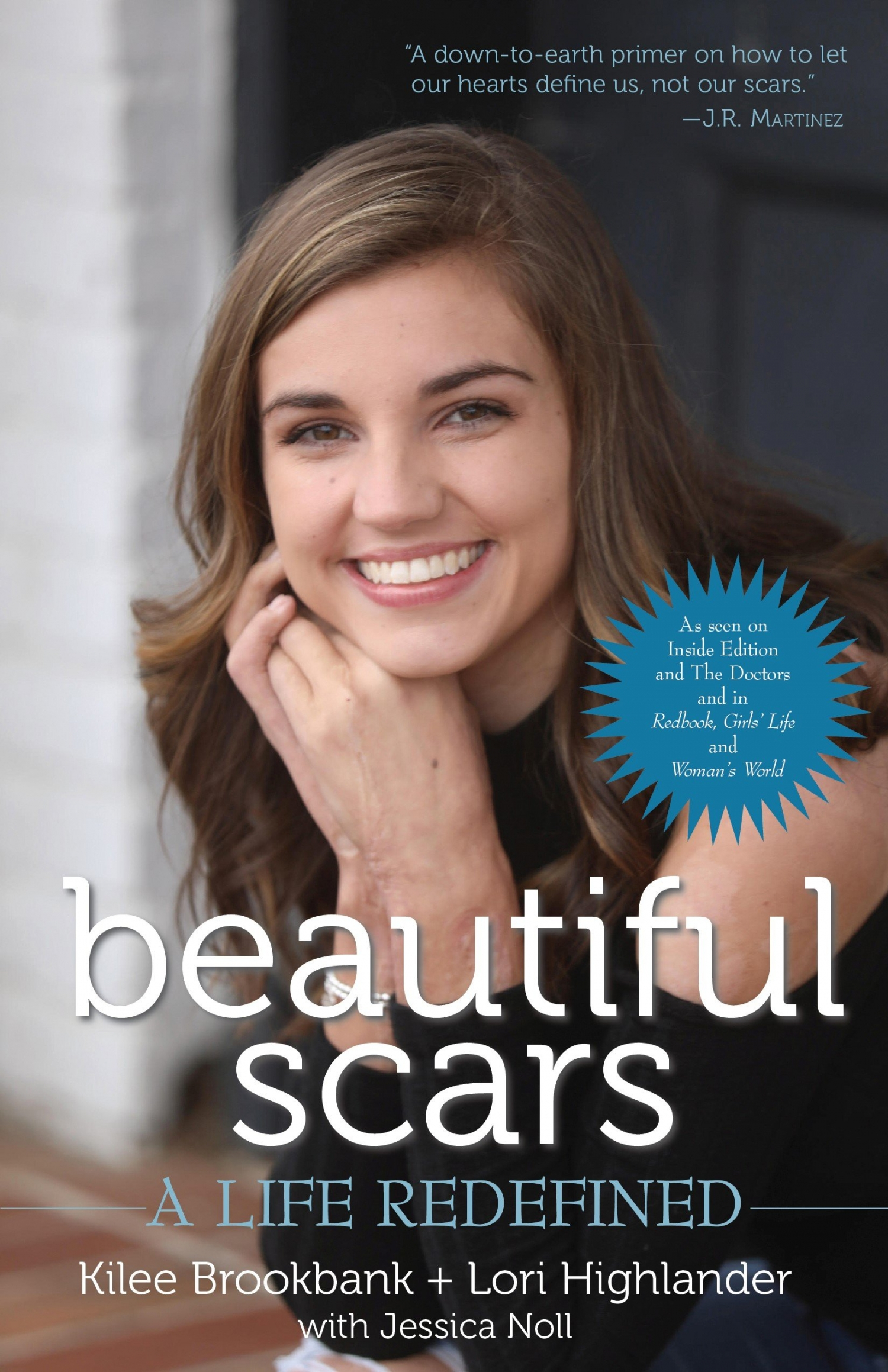 essay about beautiful scars